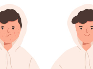 Avant-Après petits boutons sur le visage qui disparaissent avec une routine de nettoyage a l'argile