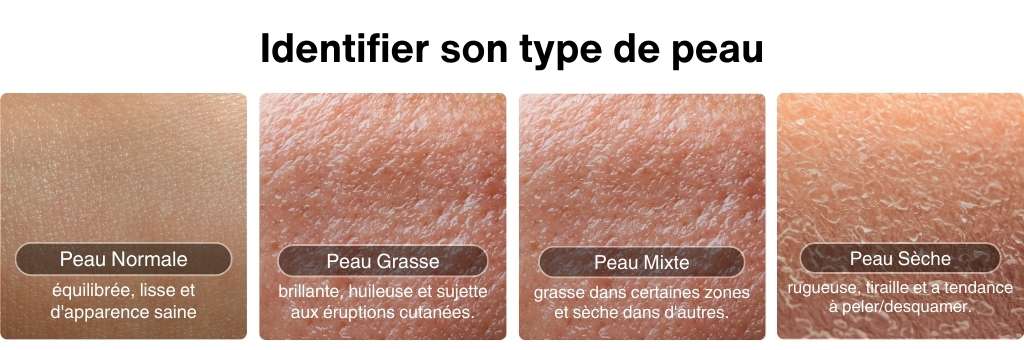 quel savon pour la peau normale, grasse, sèche ou mixte : Les quatre types de peaux principaux.
